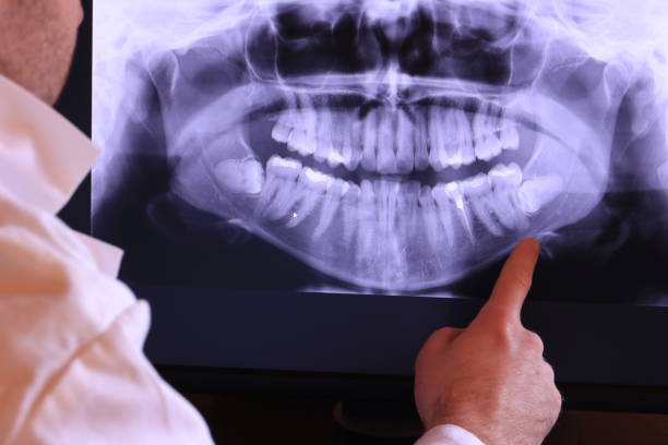 Best Emergency TMJ Treatment in Lake Sconsin, WI