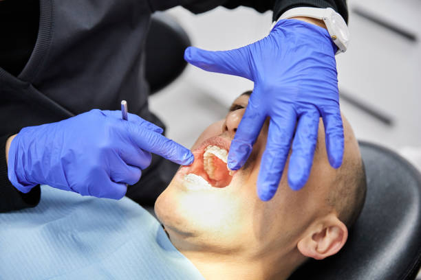 Best Emergency Dental Care for Broken or Chipped Teeth in Lake Sconsin, WI