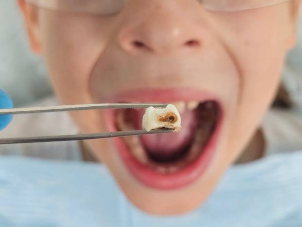 Best Weekend Emergency Dentist in Lake Sconsin, WI